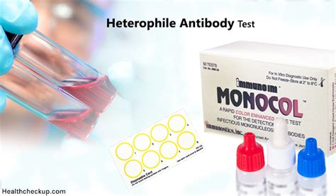 anticorpi heterofili|Heterophile antibody test